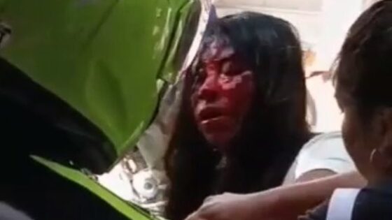 Extremely bloody womens fight in colombia Photo 0001 Video Thumb