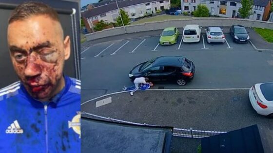 Man is brutally attacked by exfriend over undisclosed financial debts Photo 0001 Video Thumb