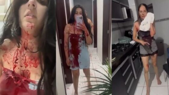 Man stabs exgirlfriend and her mother in brazil leaving them in a deplorable state of health Photo 0001 Video Thumb