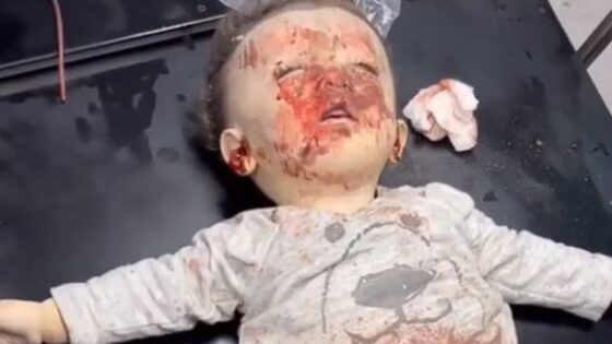 Palestinian baby who died after israeli bombings child alert Photo 0001 Video Thumb