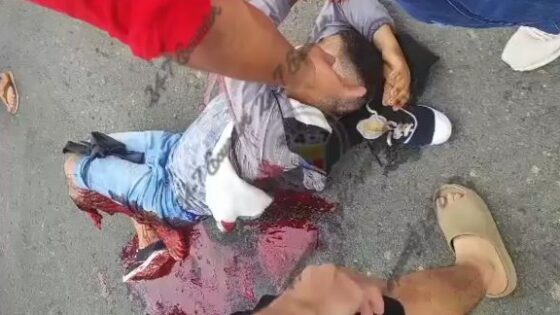 Traffic accident leaves man with crushed leg in agony on the ground Photo 0001 Video Thumb