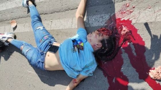 Woman is the victim of a traffic accident in colombia and her brain is left on the asphalt Photo 0001 Video Thumb