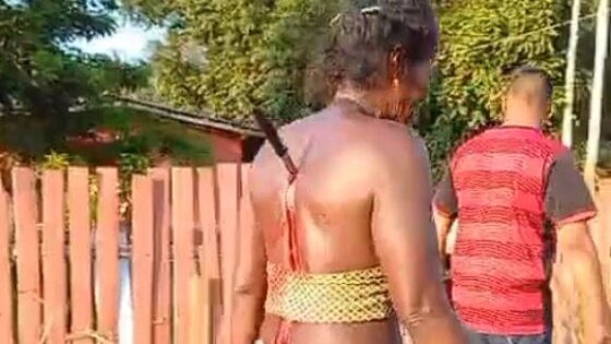 Woman with knife stuck in her back was the victim of an attempted murder but walks calmly in brazil Photo 0001 Video Thumb