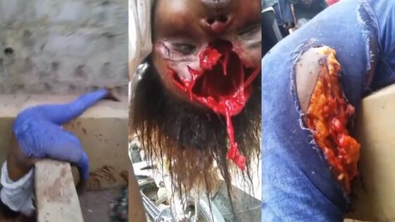 Horrible motorcycle accident in nigeria leaves woman in deplorable condition Photo 0001 Video Thumb