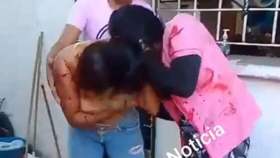 Husbands lover receives a bloody beating from furious cuckolded wife in ecuador Photo 0001 Video Thumb