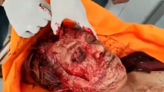 Incredible autopsy of woman brutally murdered in russia Photo 0001 Video Thumb