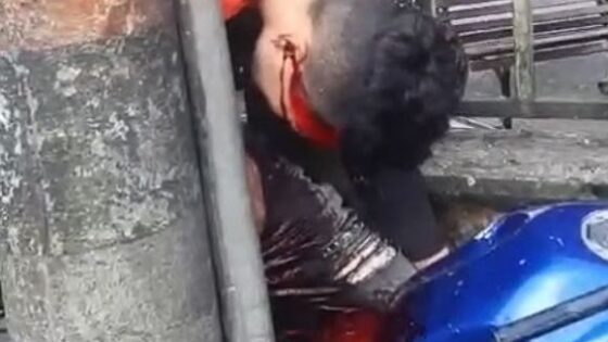 Man bleeding profusely after motorcycle accident in traffic in some latin american country Photo 0001 Video Thumb