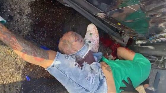 Motorcyclist in agony after traffic accident in ecuador while being helped by pedestrians Photo 0001 Video Thumb