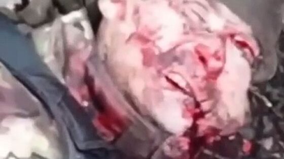 Russian soldier somehow remains alive even with his face blown off due to the russia vs ukraine war Photo 0001 Video Thumb
