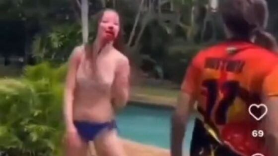 Woman in bikini fighting savagely with lots of blows to the face Photo 0001 Video Thumb