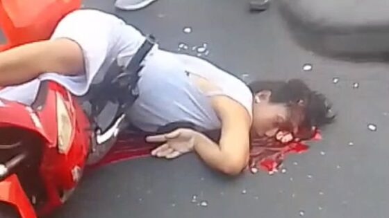 Woman suffers traffic accident and leaves her brain thrown on the ground in ecuador Photo 0001 Video Thumb