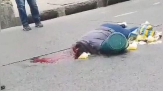 Womans skull is crushed on the asphalt due to a traffic accident again in ecuador Photo 0001 Video Thumb