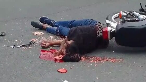 Serious traffic accident in ecuador leaves man with brain lying on the asphalt Photo 0001 Video Thumb