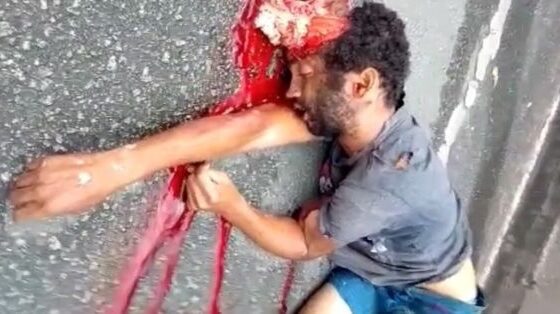 Traffic accident expels mans brain and leaves him dead on the ground Photo 0001 Video Thumb