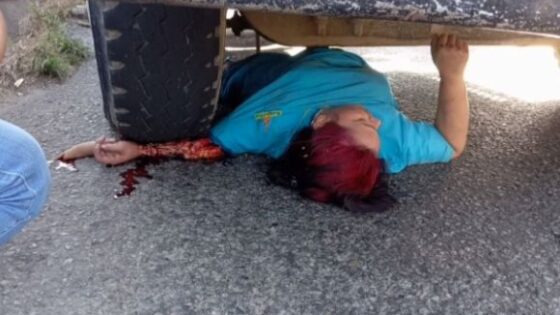 Female motorcyclist has her arm crushed under a truck in colombia Photo 0001 Video Thumb