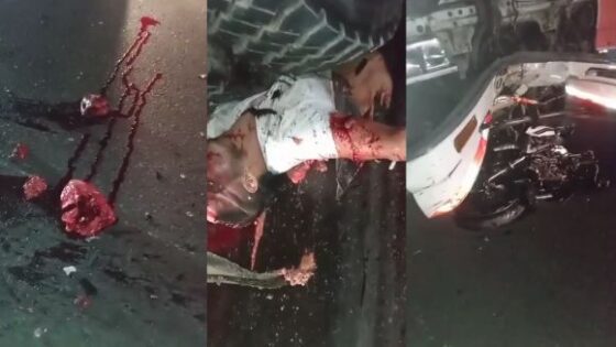 Man crushed by truck has his organs scattered across the asphalt Photo 0001 Video Thumb