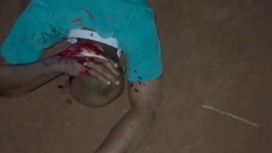 Another nigerian being killed with axes to the head by criminals Photo 0001 Video Thumb