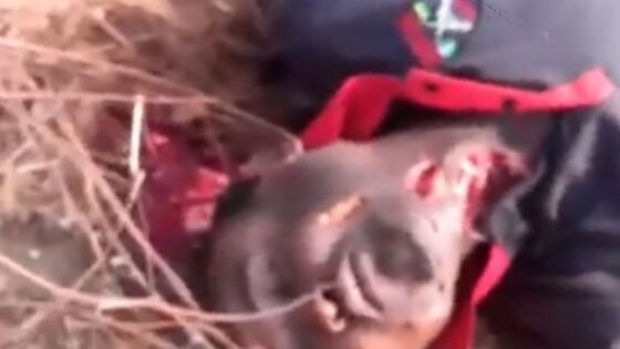 Nigerian man shot in the neck by paramilitaries Photo 0001 Video Thumb