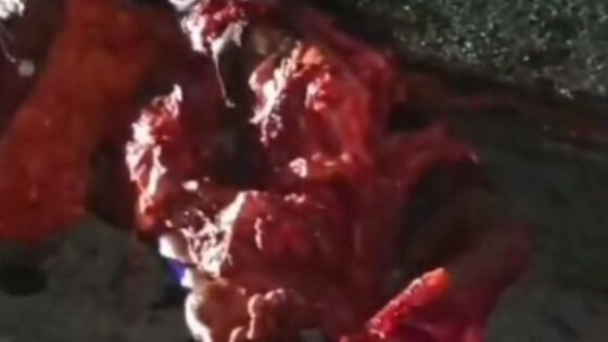 This pile of flesh was once a person but was crushed by a truck Photo 0001 Video Thumb