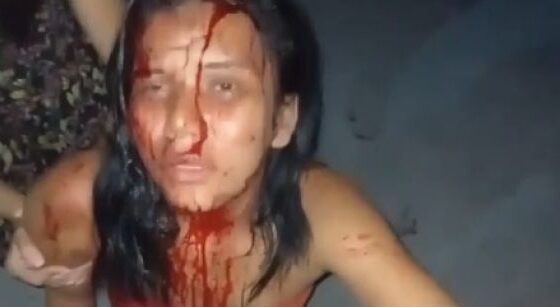 Woman brutally beaten by her husband in brazil Photo 0001 Video Thumb