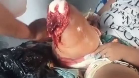 A crocodile ripped off a 32 year old womans leg Photo 0001 Video Thumb