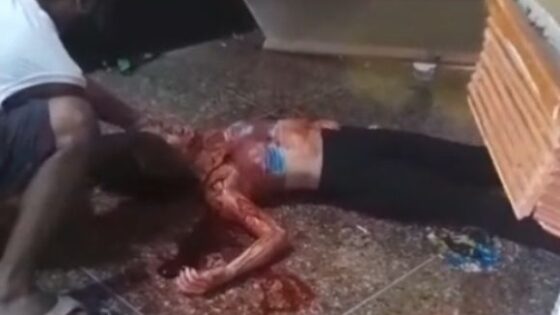 An 18 year old venezuelan girl brutally stabbed agonizes on the ground as she sees her life being taken away little by little Photo 0001 Video Thumb