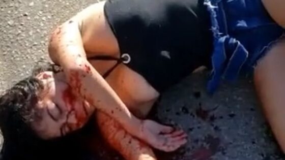 Woman taking her last breaths after traffic accident on a road in brazil Photo 0001 Video Thumb