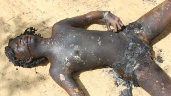 A prostitute is burned to death and her body turns black like coal in some unknown country Photo 0001 Video Thumb