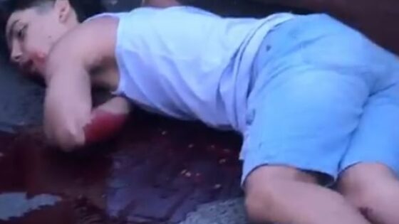 A young boy suffers a traffic accident and is left unconscious on the ground in brazil Photo 0001 Video Thumb