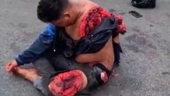 Asian man completely destroyed in traffic accident Photo 0001 Video Thumb