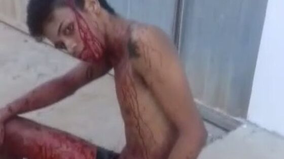 Boy mutilated by machete blows in brazil he probably suffered an assassination attempt Photo 0001 Video Thumb