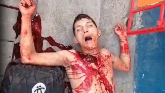 Criminal dying in brazil in a very terrible way bleeding to death Photo 0001 Video Thumb