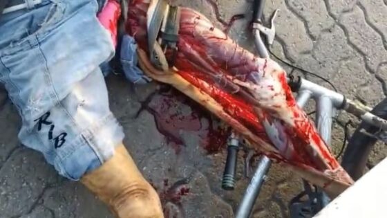 Cyclist hit by bus has his loss completely destroyed in fortaleza brazil Photo 0001 Video Thumb