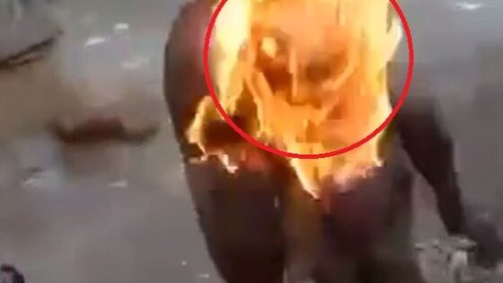 Man is partially burned alive in haiti and the shape of a demonic face appears in the flames could it be the devil motivating this evil Photo 0001 Video Thumb
