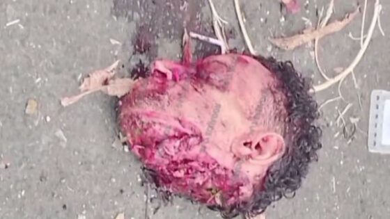 Severed head on the asphalt in ecuador with no information yet on the motive for the murder Photo 0001 Video Thumb