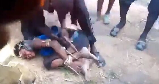 Woman tortured with melted plastic dripping onto her body in some african country Photo 0001 Video Thumb
