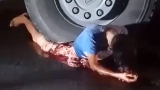 Young boy still alive after being crushed by truck wheel Photo 0001 Video Thumb