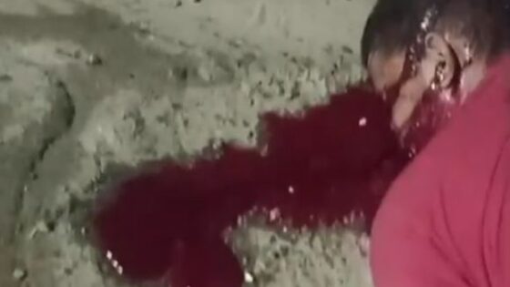 Man on crutches shot dead in the nova metrópole neighborhood in brazil Photo 0001 Video Thumb