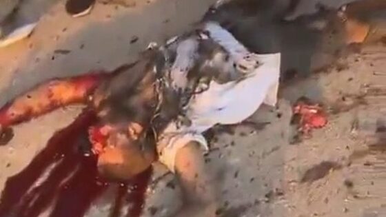 Body of a bleeding dead guy after israeli air attack Photo 0001 Video Thumb