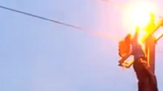 Boy electrocuted by high voltage line Photo 0001 Video Thumb