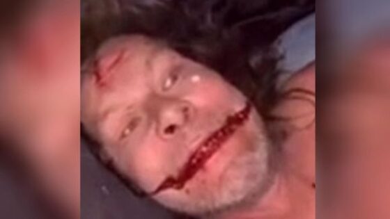Estonian teenagers brutally murdered a man with punches and kicks Photo 0001 Video Thumb