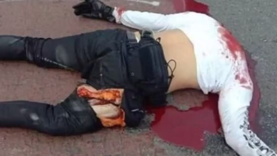 Head torn off and femur fractured in motorcycle accident in brazil Photo 0001 Video Thumb