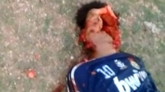 His face is completely open from gunshots in brazil brutal execution Photo 0001 Video Thumb