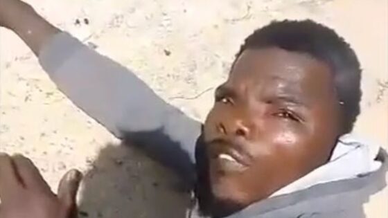 Man has his hand bitten off with a machete in haiti for reasons still unknown most likely punishment for robbery Photo 0001 Video Thumb