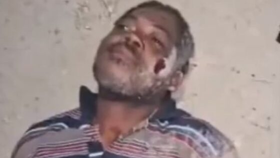 Man is forced to eat his own ear before being burned alive in haiti for reasons still unknown those savages Photo 0001 Video Thumb