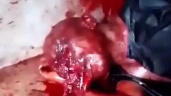 Man with his face completely destroyed but still alive in nigeria Photo 0001 Video Thumb