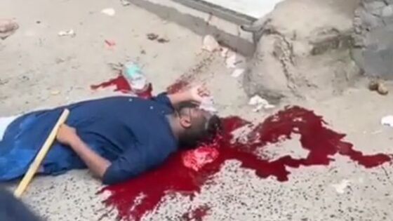 Mans brain scattered by probably gunshot 2024 bangladesh quota protest Photo 0001 Video Thumb