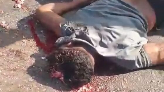 Motorcyclist dies after being the victim of a traffic accident and having his skull blown off on the asphalt in brazil Photo 0001 Video Thumb