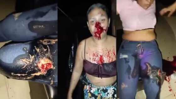 Nightclub shooting in colombia leaves women injured and bleeding Photo 0001 Video Thumb