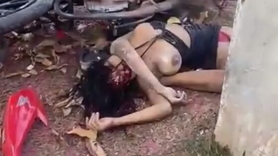 Traffic accident in brazil leaves woman with exposed breasts Photo 0001 Video Thumb